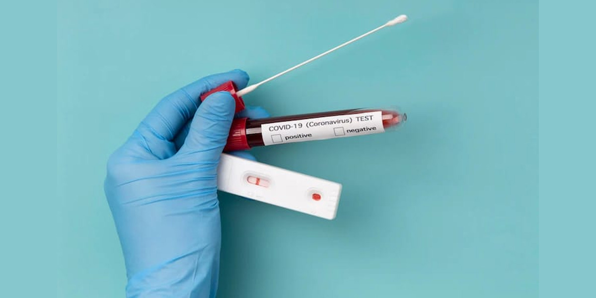 PPKM Dihentikan, Pemerintah Tak Wajibkan PCR dan Antigen - tes covid - www.indopos.co.id