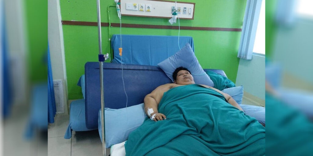 Sempat Gagal Napas, Belasan Dokter RSCM Tangani Pria Obesitas 300 Kg - obesitas 1 - www.indopos.co.id