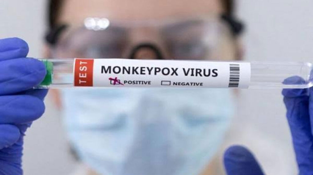Monkey-Pox-Virus